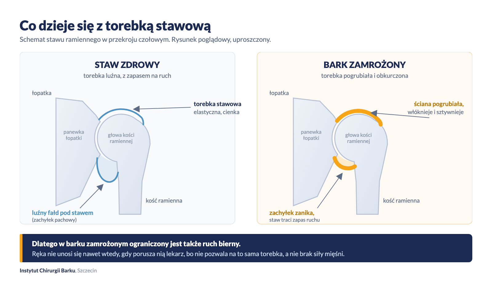 Schemat: torebka stawowa zdrowa i obkurczona w barku zamrożonym
