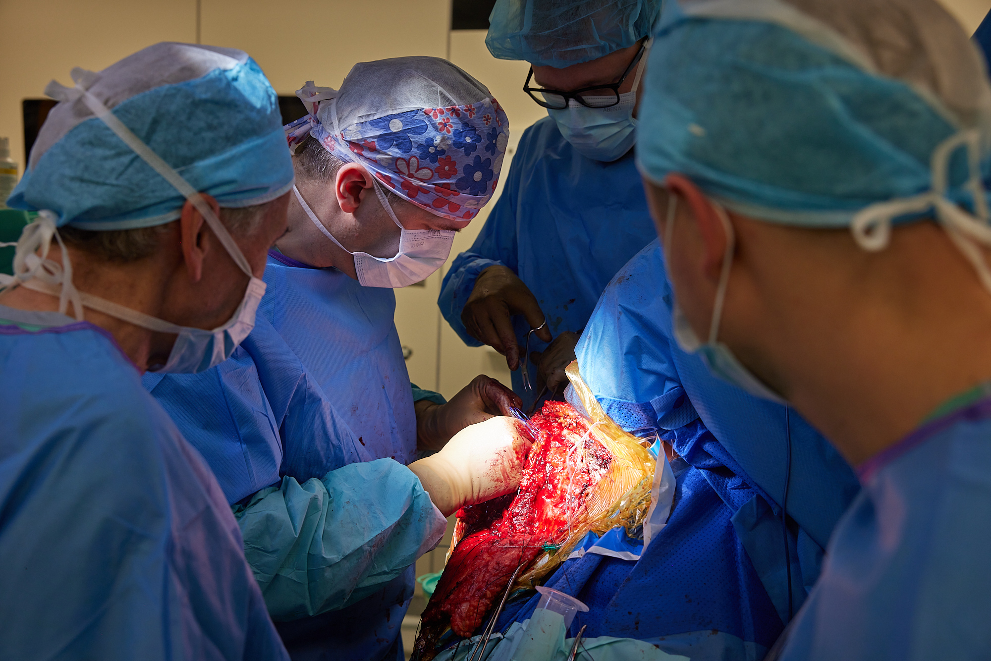 Międzynarodowy zespół chirurgów podczas operacji rewizyjnej barku w 107 Szpitalu Wojskowym w Wałczu