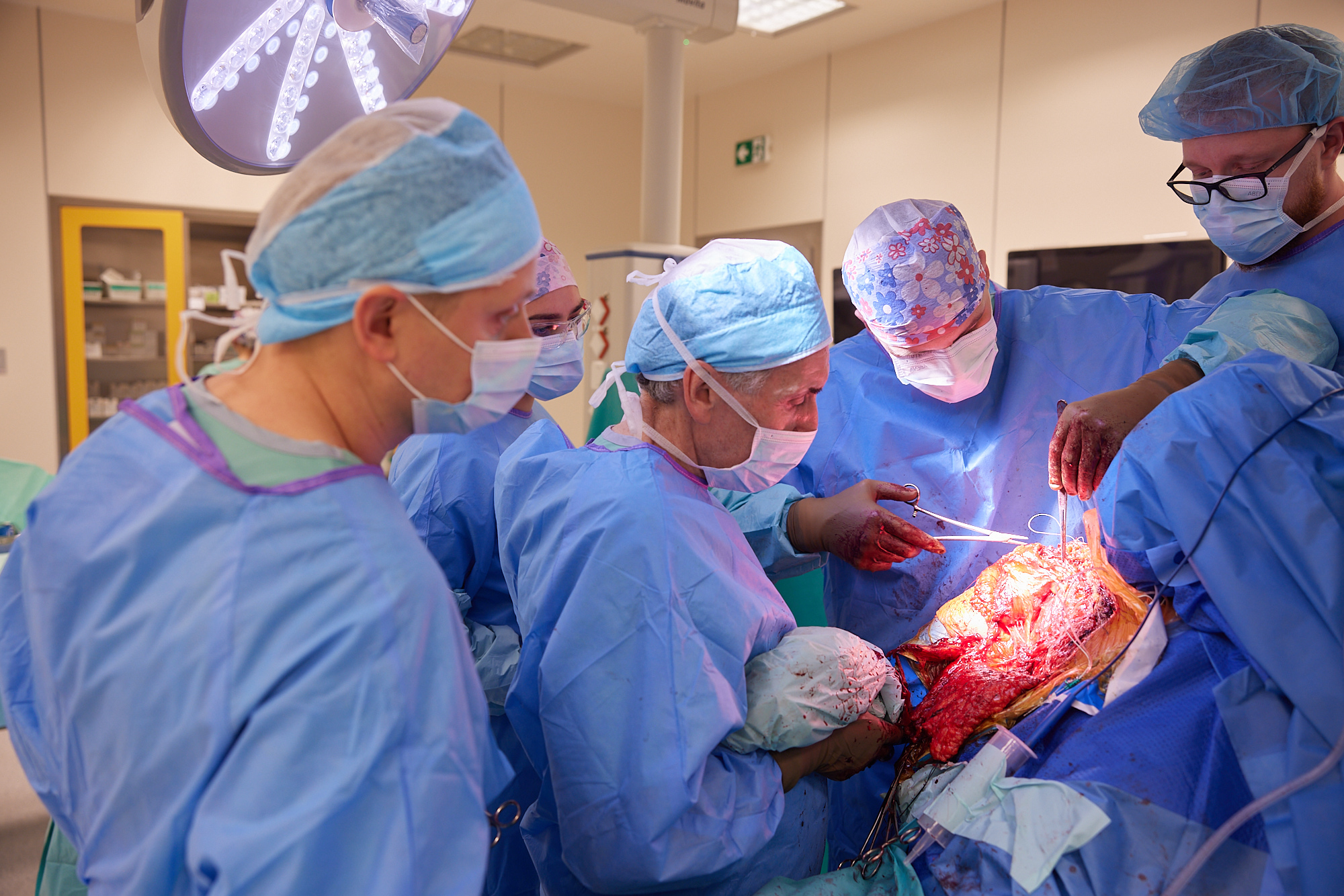 Dr Valenti prowadzi etap transferu mięśnia piersiowego podczas operacji rewizyjnej barku