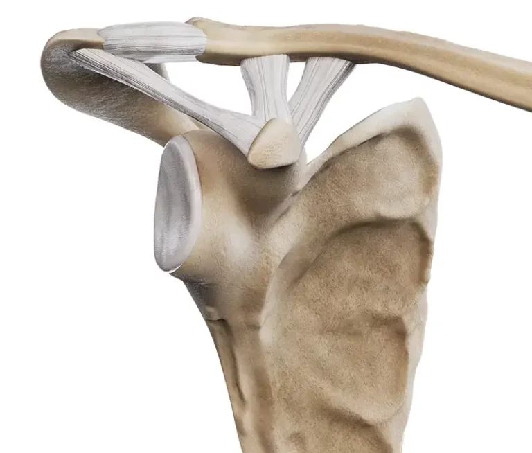 Urazy stawu barkowo-obojczykowego - stopień 0